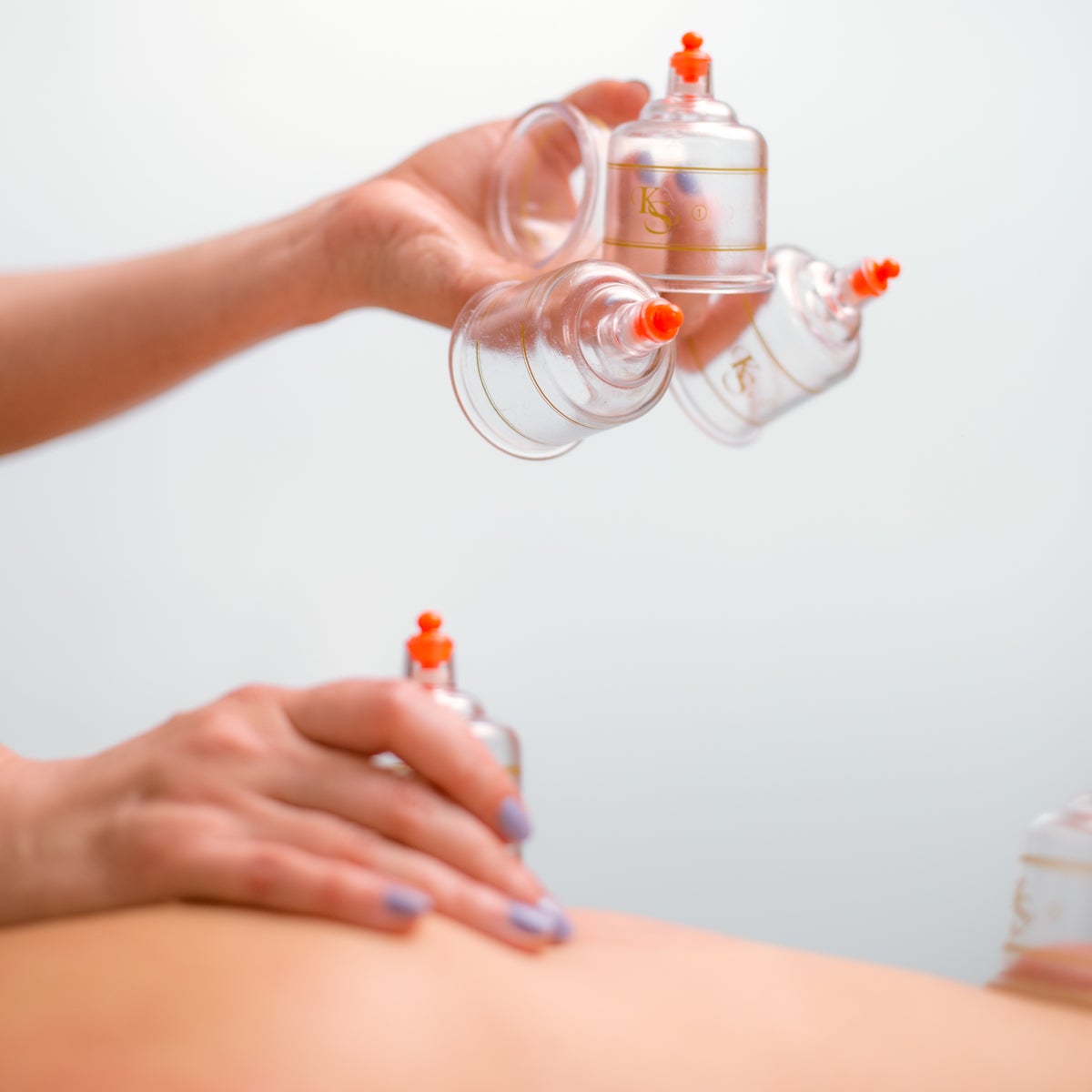 free therapeutic options, cupping, scraping, essential oils ...